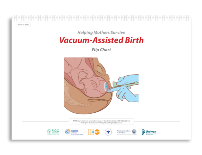 Flip Charts - Vacuum Assisted Birth