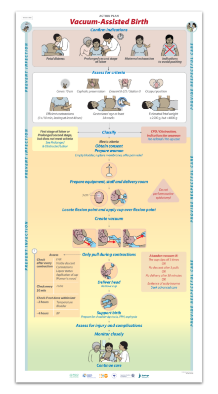 Action Plan – Vacuum Assisted Birth (Qty. 5) - Helping Mothers Survive ...