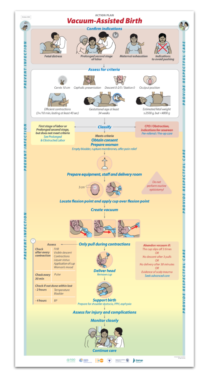 Action Plan - Vacuum Assisted Birth (Qty. 5)