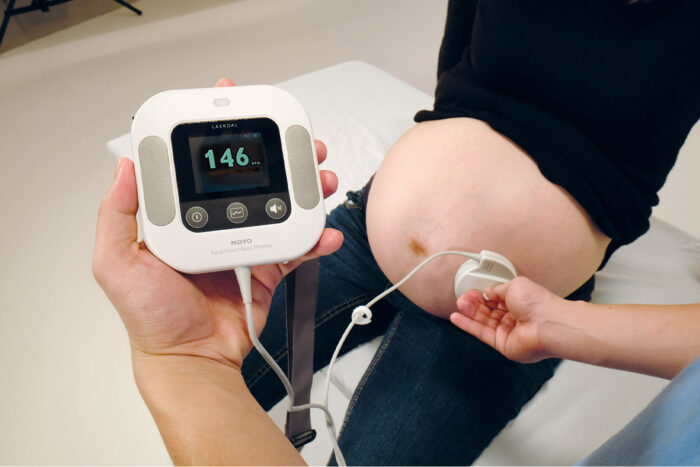 Product image for the Moyo fetal heart rate monitor